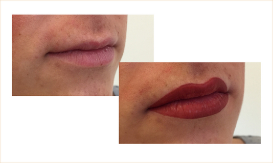Lippen04_FACE_TUNE_vorher-nachher
